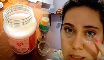 Termina con las arrugas de los ojos con esta crema casera. Se prepara con pocos ingredientes.