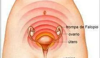El síndrome premenstrual es mucho más común de lo que se cree 