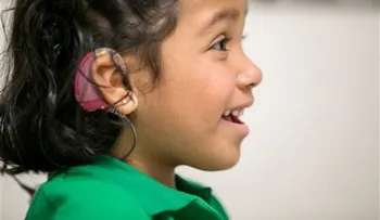 Prueban implante para ayudar a niños con sordera 