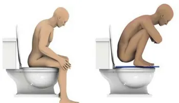 ¿Vas correctamente al baño? Conoce la postura para sentarse