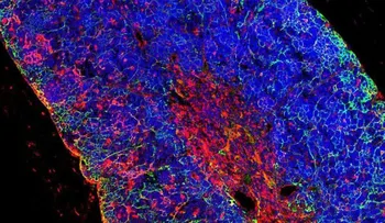  Generan leucemia de linfocitos T "in vivo" a partir de una célula sana 