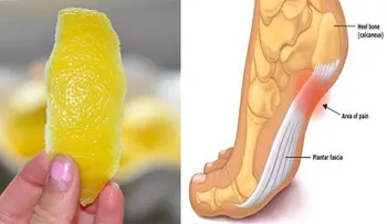 Truco con la cascara de un limón para deshacerse de la inflamación y el dolor crónico!!!