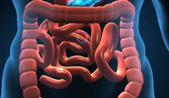  Expertos avanzan en tratamientos para el "síndrome del intestino corto" 