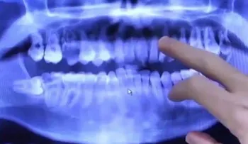 Muestra sus dientes luego de 20 años sin lavárselos