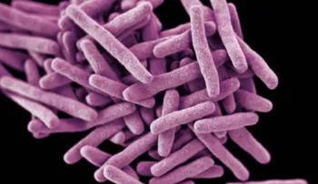 Preocupación en EE.UU. por paciente con tuberculosis resistente a medicamentos