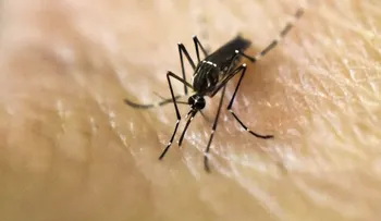 Nace el primer bebé con microcefalia por zika en España