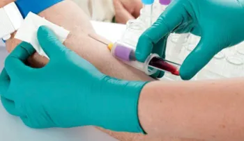 Análisis de sangre detectaría alzhéimer hasta 20 años antes de su aparición