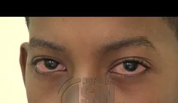  Entre un 4 y 14 por ciento niños en edad preescolar tienen problemas para ver cosas cercanas 