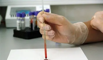  Un nuevo análisis de sangre ayuda a predecir el riesgo de cáncer de pulmón 