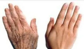 50 años, pero sus manos lucen de 20, sin arrugas ni cirugias. ASI LO LOGRO!!!