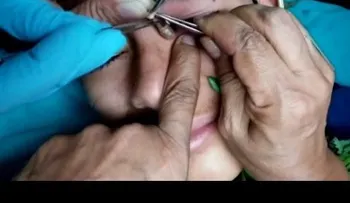 Conozca estos parásitos en el ano, y otros casos asquerosos 
