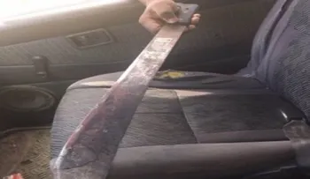 Crueldad: Mujer quema a un hijo con un machete caliente en Montecristi