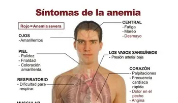 Alarmante: El 61 por ciento niños de seis a once meses tiene anemia en RD; y el 34 por ciento de las mujeres