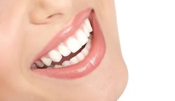10 mitos y verdades del blanqueamiento dental
