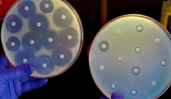 La superbacteria resistente a los antibióticos que preocupa a Estados Unidos