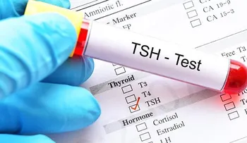 Hipotiroidismo subclínico: no prescribir hormonas de forma rutinaria