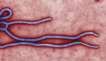 El ébola sigue imparable y el mundo busca controlar letal enfermedad