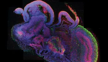 Crean por primera vez pequeño cerebro a través de células de piel