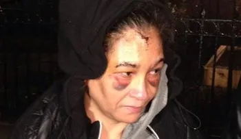 Presunto violador propina golpiza a dominicana