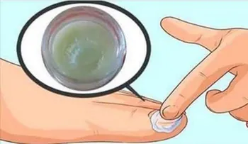 El "rompe hongos" que elimina todos los hongos de las uñas