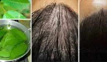 Los médicos sorprendidos con esta hoja hace creer el cabello como loco 