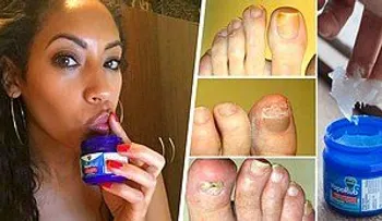 13 usos increíbles del VICKS VAPORUB que ni los médicos pueden explicar...