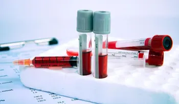 La leucemia es un subtipo de cáncer que afecta a las células sanguíneas 