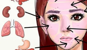 Lo que tu rostro dice sobre tu mal funcionamiento en tus organos 