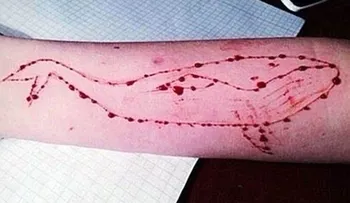 "La ballena azul", el siniestro juego suicida ya llegó a Sudamérica