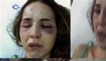 República Dominicana encabeza índice femicidios AL y El Caribe