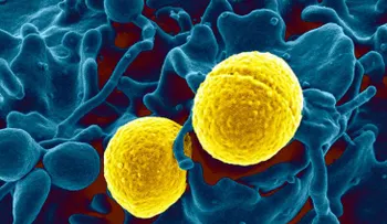 Microorganismos resistentes a antibióticos aumentaron en la última década