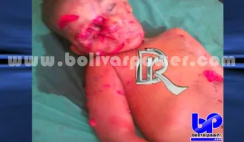 Perros â??pitbullâ? matan niño de 3 años en Samaná