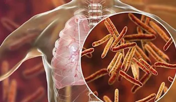 Tuberculosis: un nuevo método acorta el tiempo de diagnóstico y epidemiología