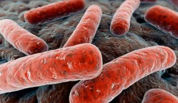 5 bacterias que se alimentan de la carne y provocan enfermedades
