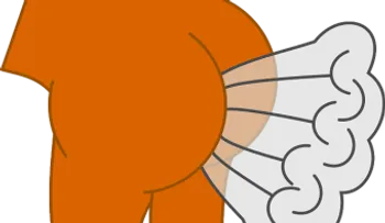 El exceso de flatulencia podría ser síntoma de una enfermedad 
