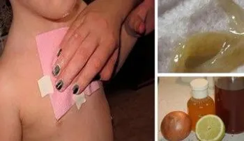 Elimina la tos y flemas de los pulmones en una sola noche, efectivo en niños y adultos