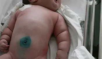 Una mujer en Rusia da a luz niña de 6,3 kilos de modo natural y sin anestesia; deja a todos impactado