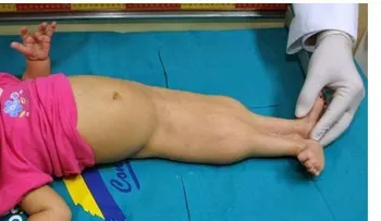 Nace un bebé Sirena; tiene que mirarlo