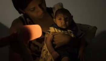 Colombia confirma dos casos de microcefalia asociados a zika
