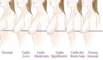 Hábitos diarios que causan un busto caído