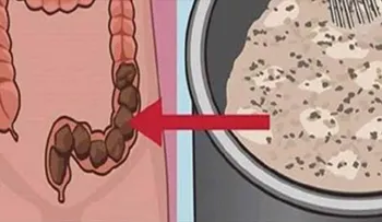 Imperdible, conoce el efectivo remedio que elimina toda la mugre y la caca acumulada del colon...! 