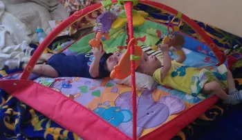 Familiares piden orar por siameses Ezequiel y Manuel, separada con éxito por médicos de Costa Rica