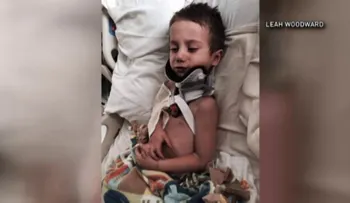 Un niño sobrevivió a una decapitación interna sin cirugía