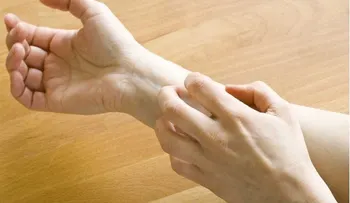 ¿Por qué da comezón picadura mosquito?