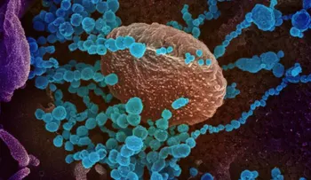 Crean inhibidores que bloquean interacción entre SARS-Cov-2 y receptor humano