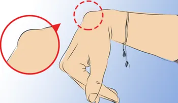 Si esto te ocurre en la muñeca de tu mano, llama urgente un médico. EL MOTIVO ES DE GRAVEDAD !!!