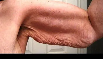 Esta es la forma de eliminar para siempre la FLACIDEZ de los brazos; solo necesita: