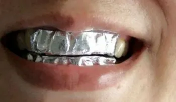 El truco perfecto para blanquear tus dientes con papel de aluminio