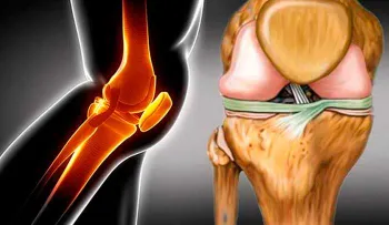 Como reparar nuestros cartílagos con vitamina 