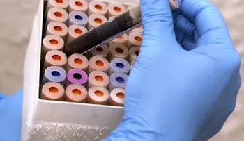 Por el zika, EEUU anuncia restricciones para donar sangre